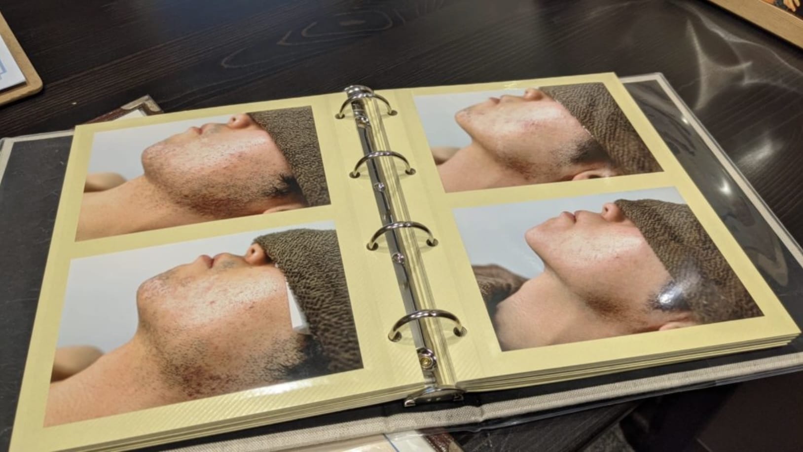 ビフォー＆アフター的な施術例のアルバム