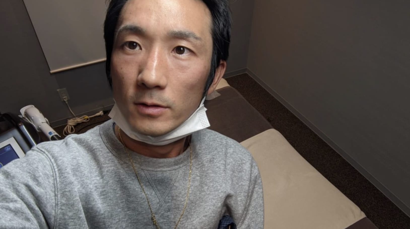 体験ヒゲ脱毛を受ける筆者