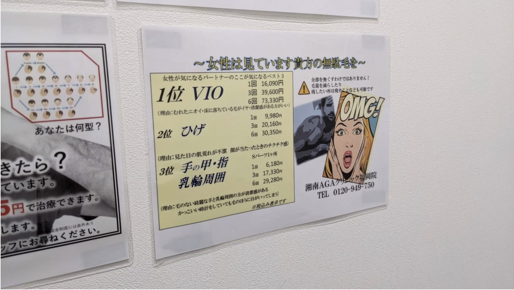 湘南美容AGAクリニック福岡院カウンセリングルーム内の張り紙
