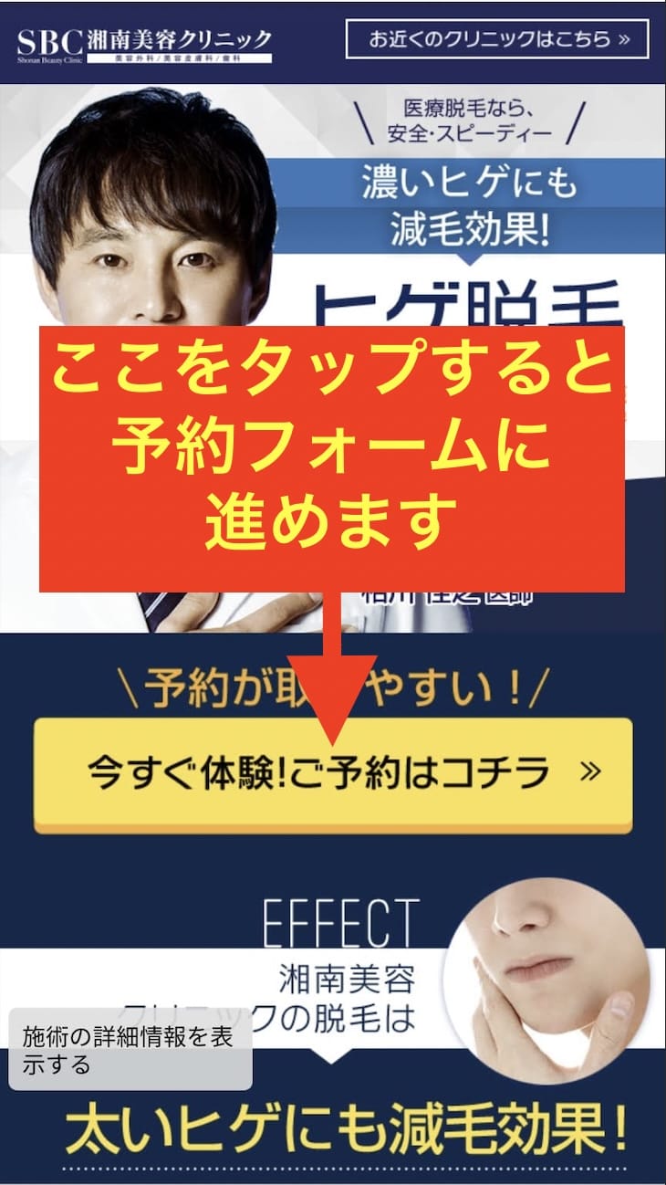 湘南美容クリニックのトップページにある予約フォームボタン