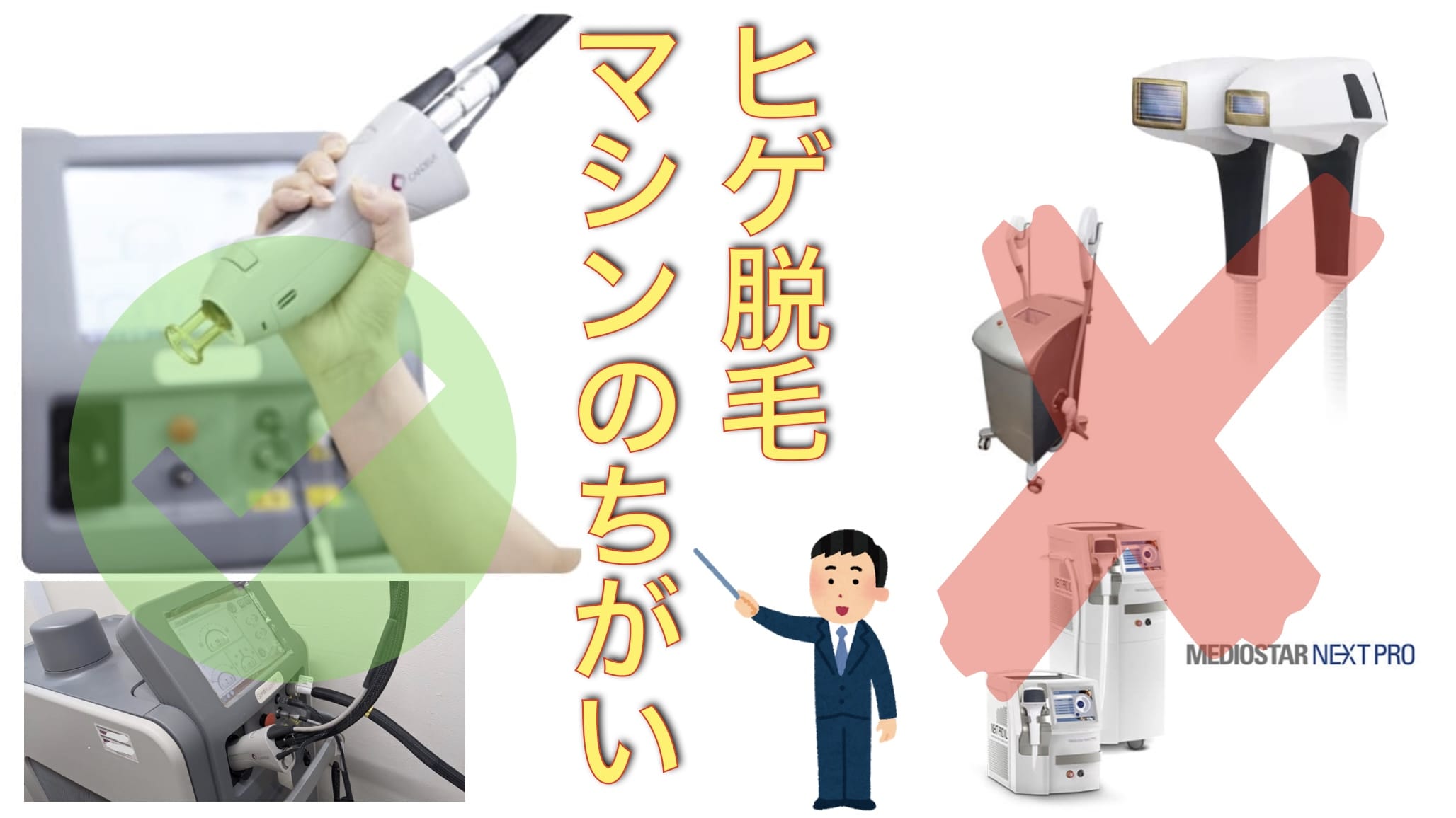 【30秒で解決】ヒゲ脱毛に使われる医療レーザーおすすめマシンはこれ！【定番5種をまとめて解説】サムネイル画像