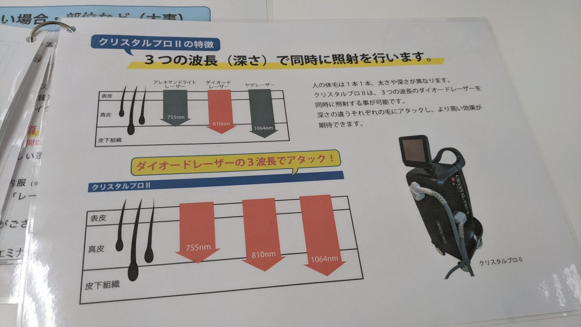 エミナルクリニックメンズの脱毛マシンの説明表（クリスタルプロ2）