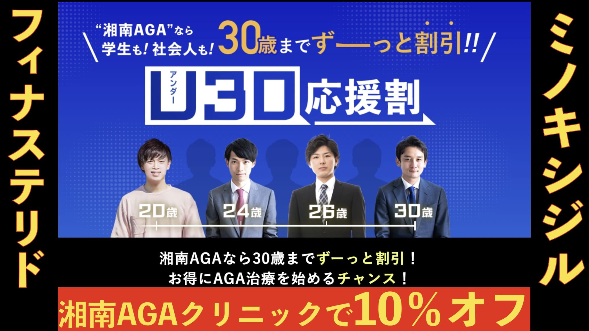 【新登場】AGA治療がずっと10％オフで受けられる湘南美容クリニックのU30応援割が開始サムネイル画像
