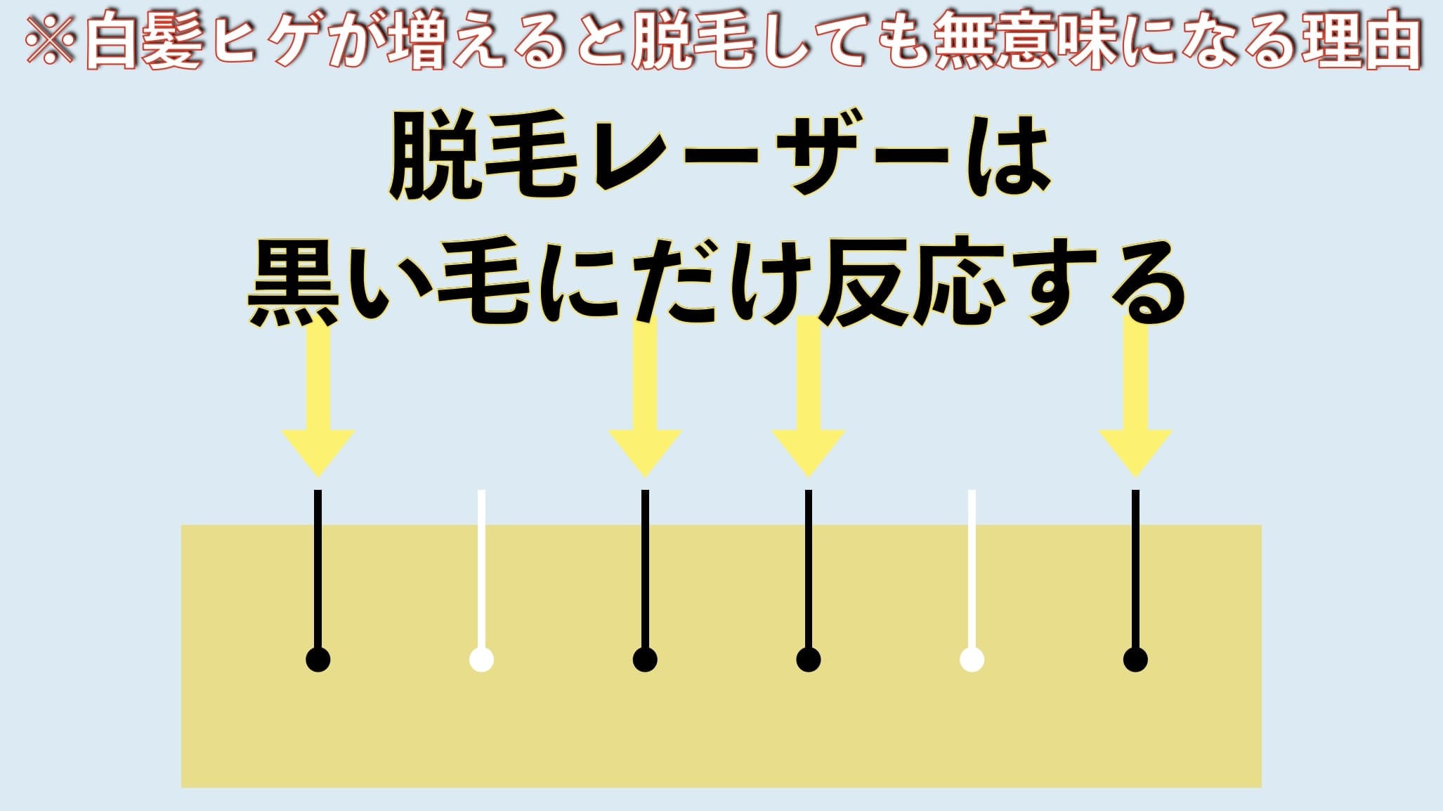 ※白髪ヒゲが増えると脱毛しても無意味になる理由