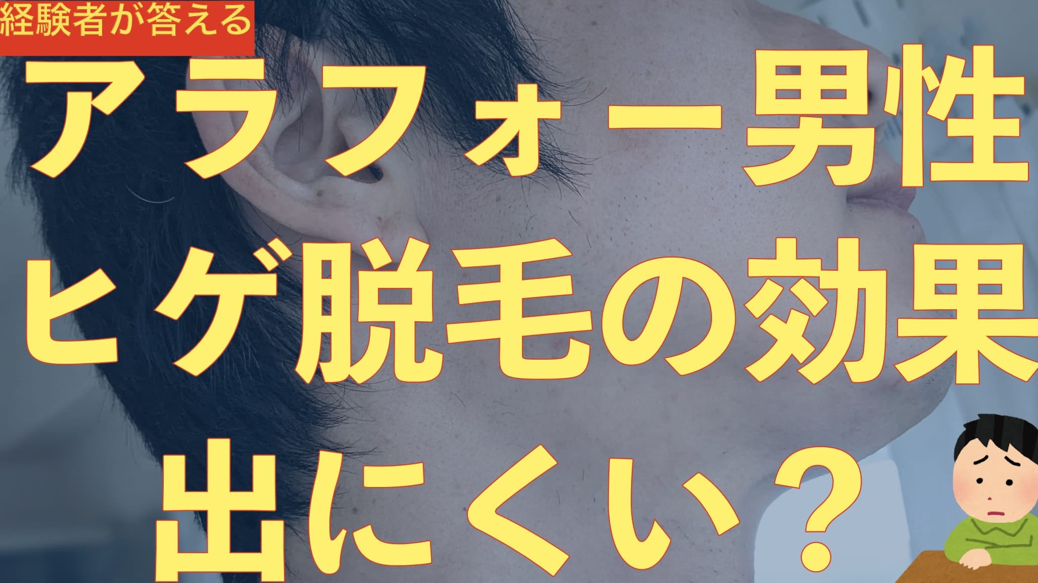アラフォー男性だと医療レーザーヒゲ脱毛が効かなくなるってマジ？【ギリ間に合います】サムネイル画像