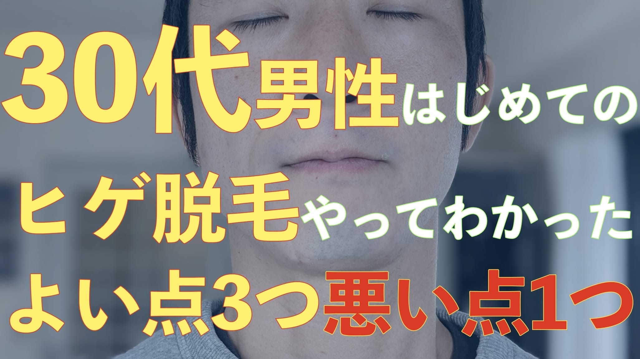 30代男性が語る。医療レーザーヒゲ脱毛してよかったこと3つと悪かったこと1つ