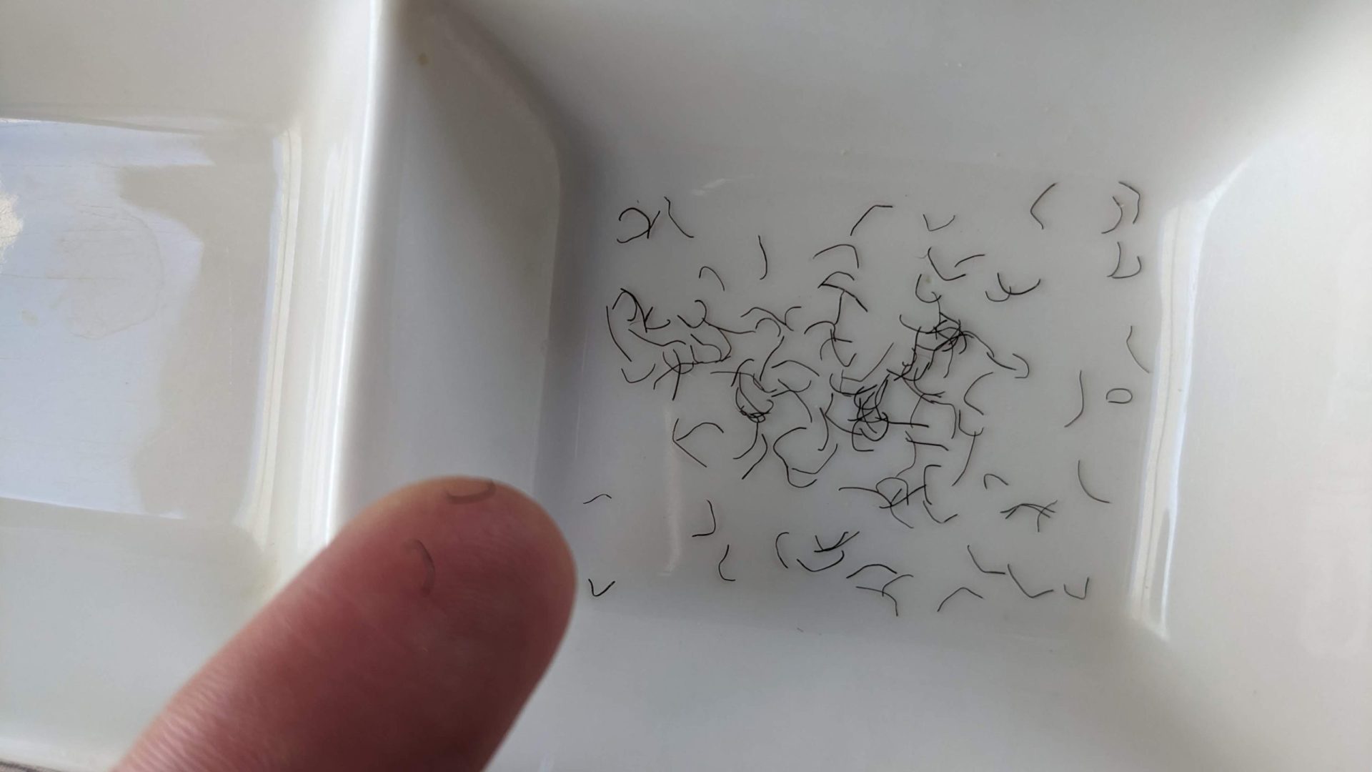 つまんで抜けてきた毛の一部