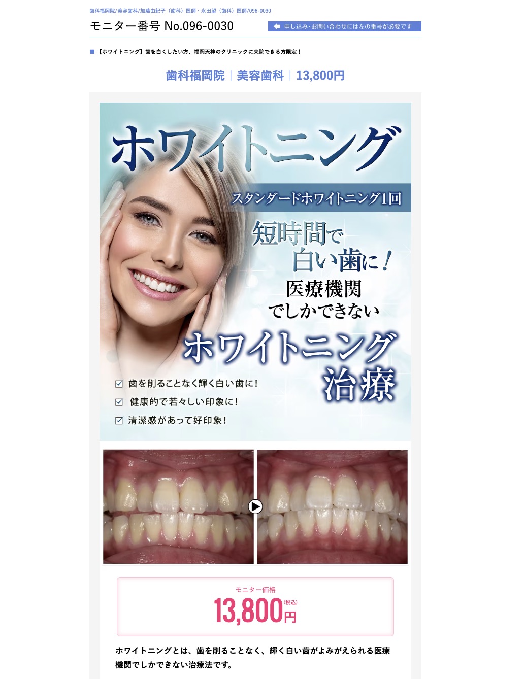 湘南美容歯科クリニックHPより画像引用