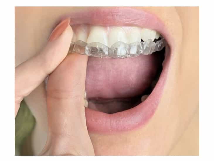 湘南美容クリニック歯科のHPより画像引用