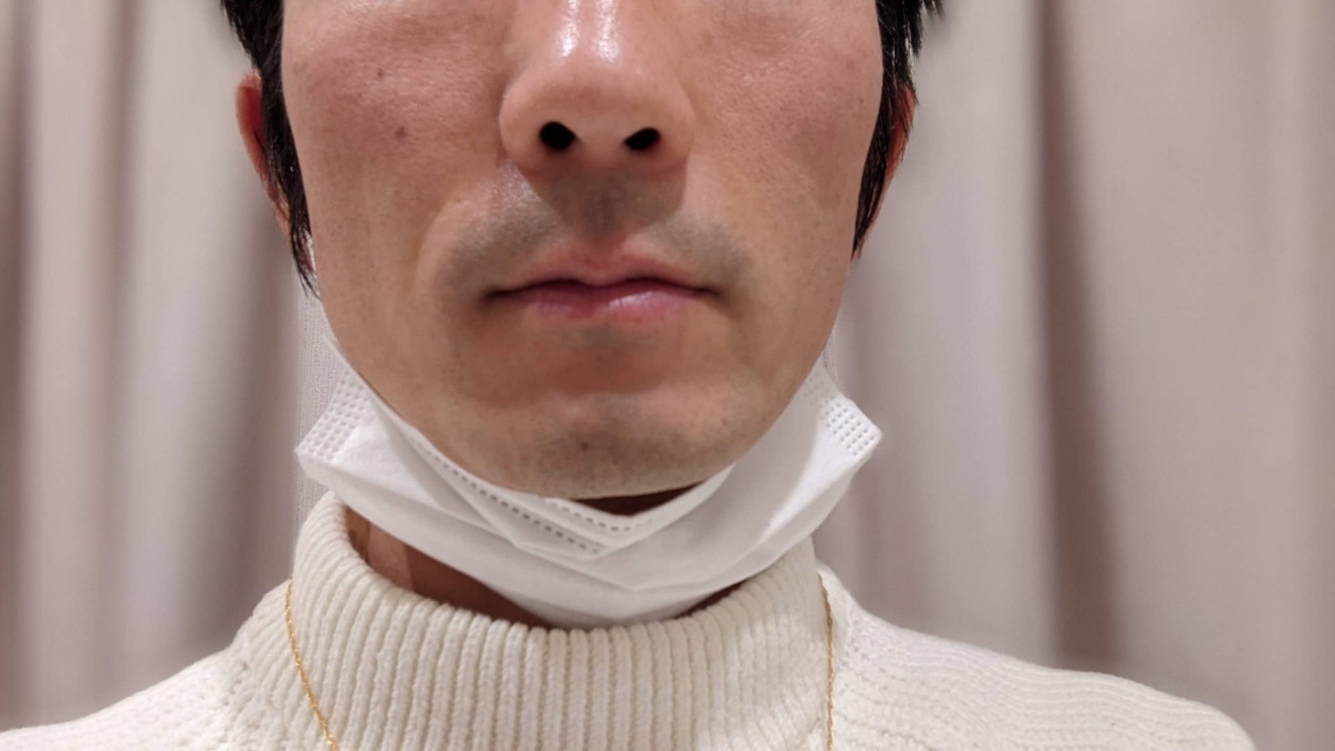 照射直後の様子。とくに赤みなどもでなかった。