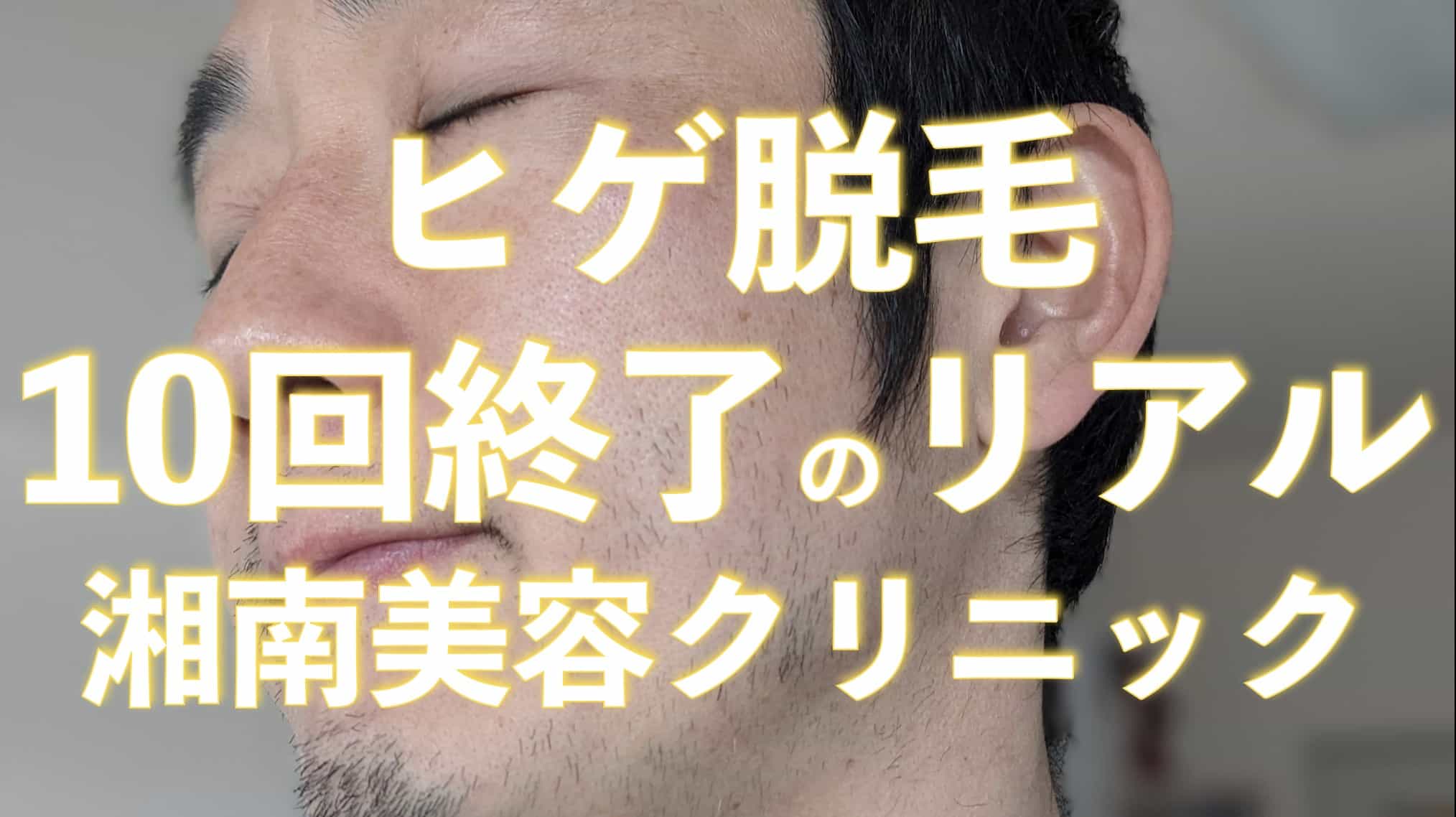 『湘南美容クリニックのメンズ髭脱毛』10回目が終わったヒゲの状態がこちら。サムネイル画像
