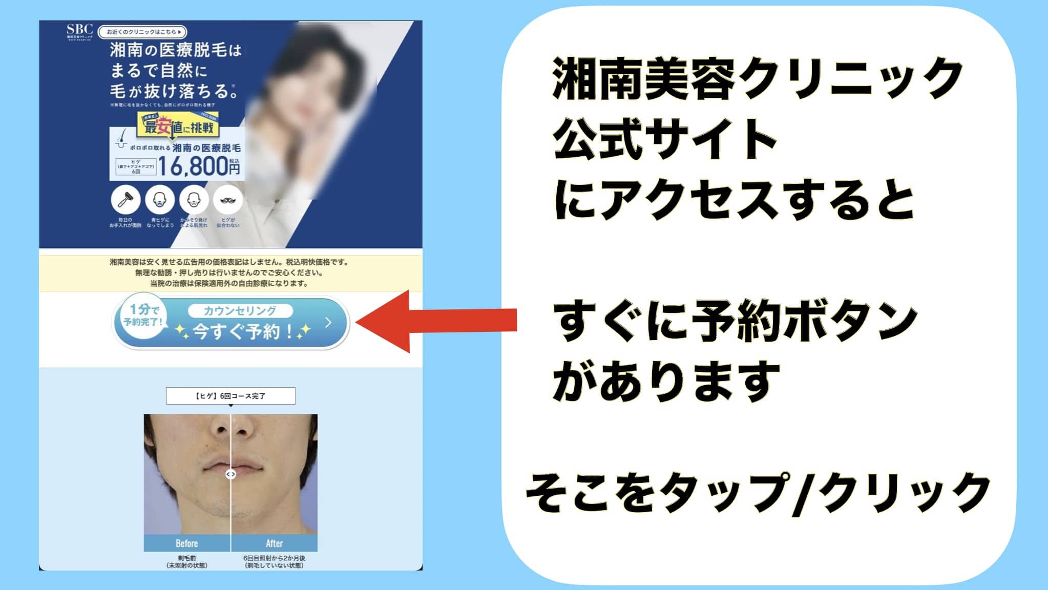 湘南美容クリニック公式サイトにアクセスすると、すぐに予約ボタンがあります。そこをタップ/クリック