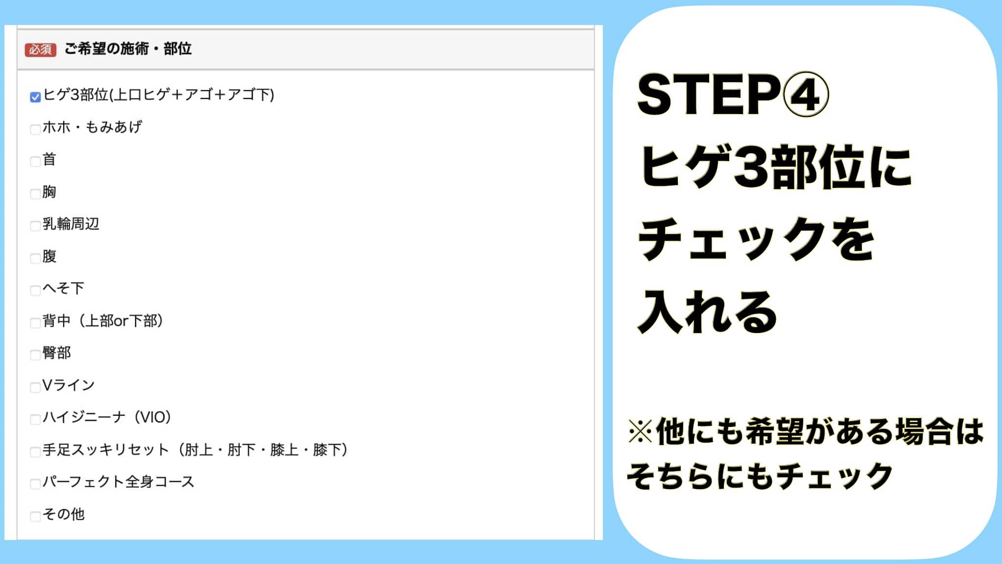 STEP④ヒゲ3部位にチェックを入れる。 ※他にも希望がある場合はそちらにもチェック