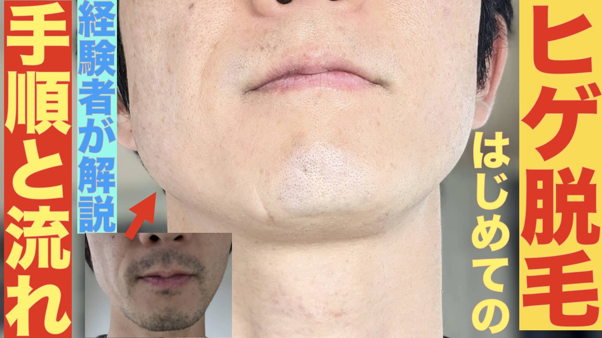 はじめてのヒゲ脱毛の手順・当日までの流れを経験者がわかりやすく解説！サムネイル画像