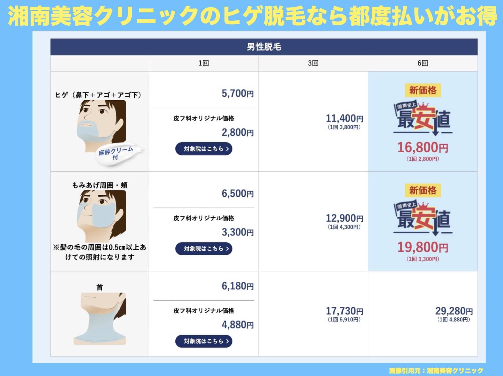湘南美容クリニックのヒゲ脱毛都度払いの金額表