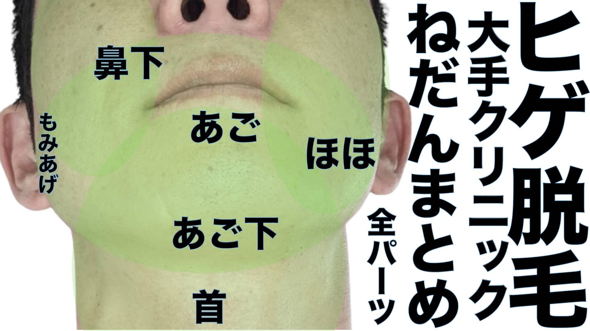 ヒゲ脱毛大手クリニック値段まとめ全部位サムネイル画像