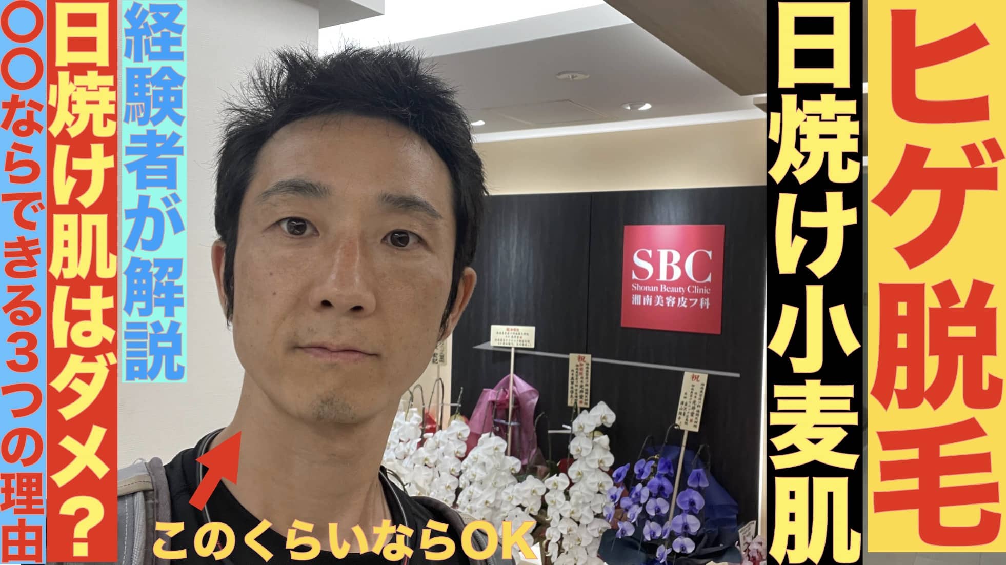 日焼けしてるけどヒゲ脱毛受けられる？湘南美容クリニックならOKな3つの理由サムネイル画像