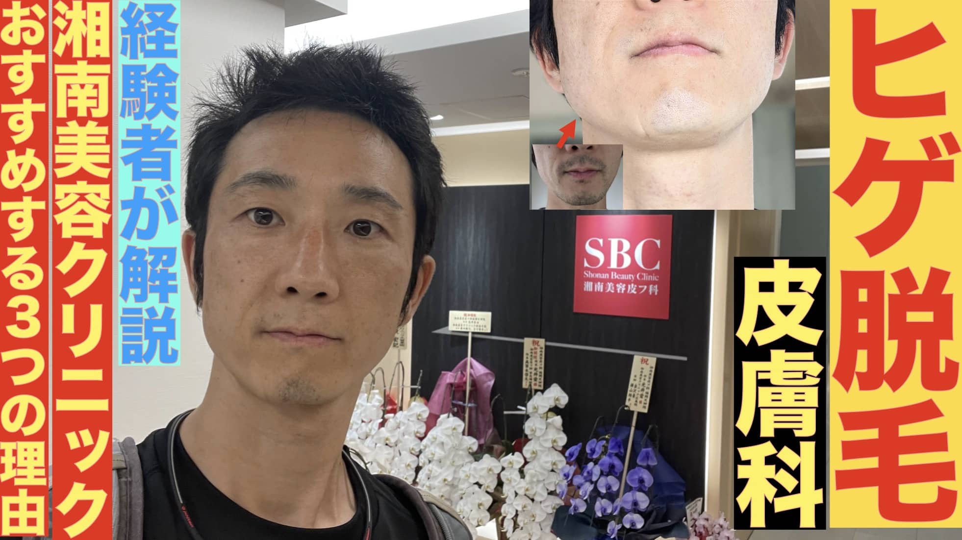 皮膚科のヒゲ脱毛なら湘南美容クリニックがおすすめな3つの理由【1回2800円】サムネイル画像