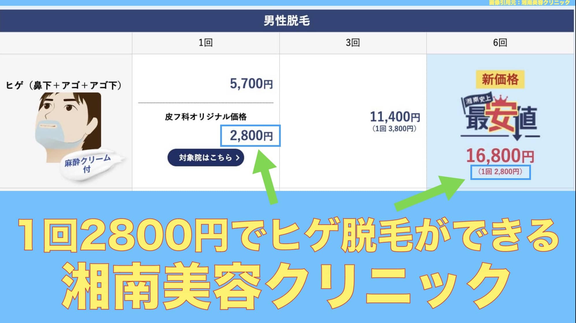 1回2800円でヒゲ脱毛ができる湘南美容クリニック料金表