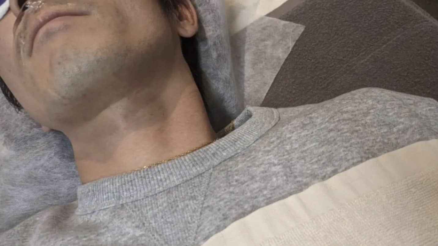 某脱毛サロンにて施術前にジェルを塗られている筆者