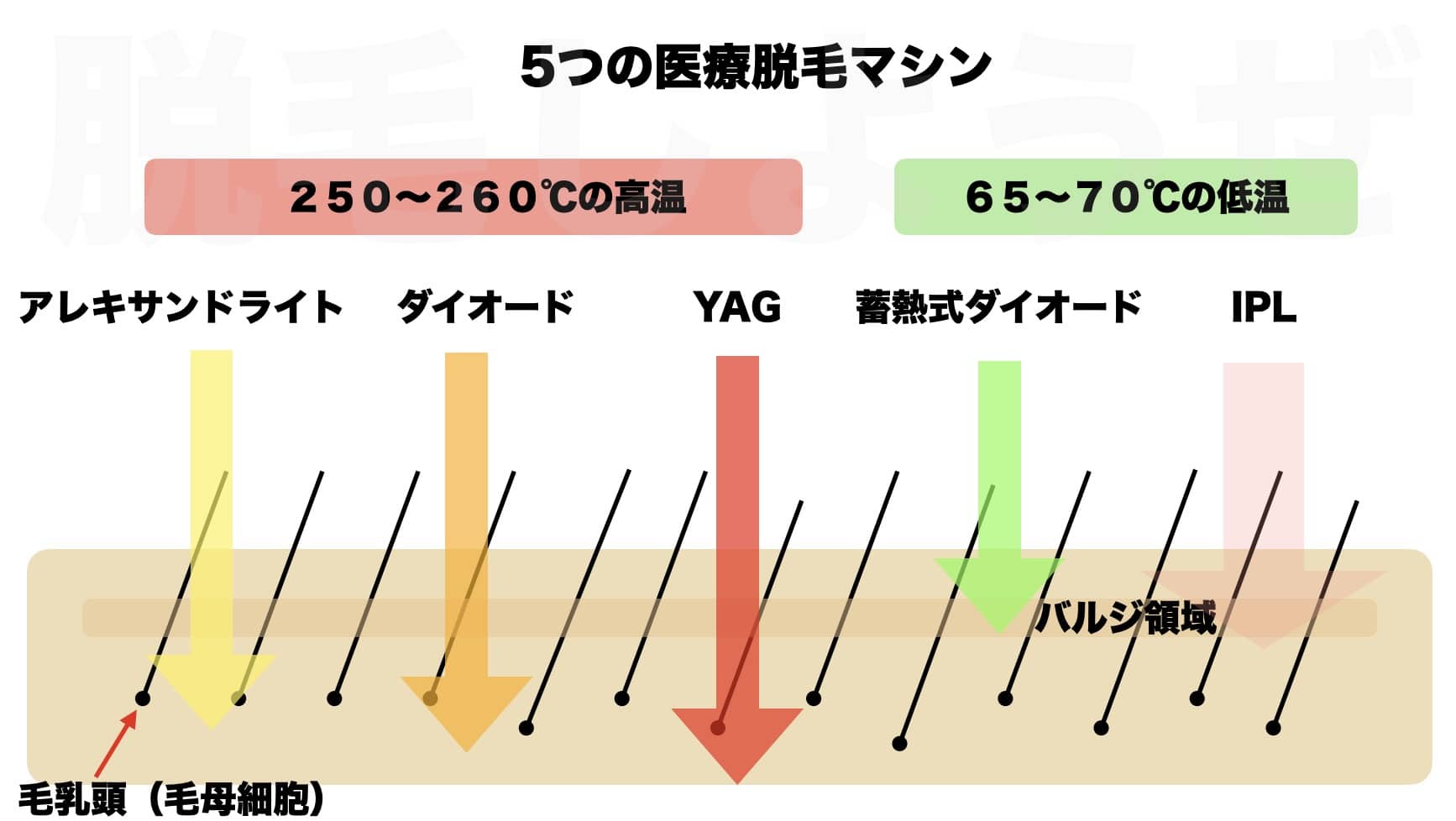 医療脱毛クリニックのマシンの種類