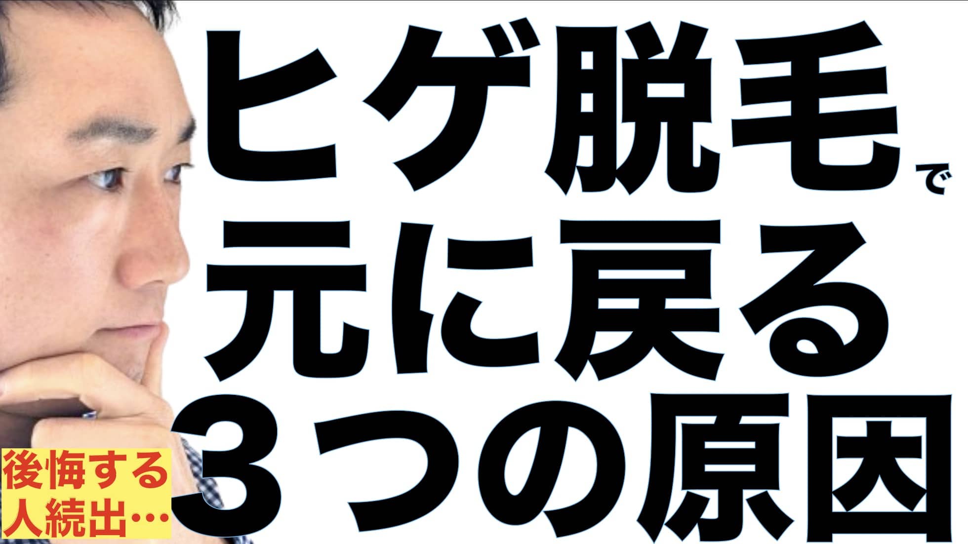 ヒゲ脱毛したのに元に戻る人見て！〇〇はお金のムダ！３つの原因と解決策サムネイル画像