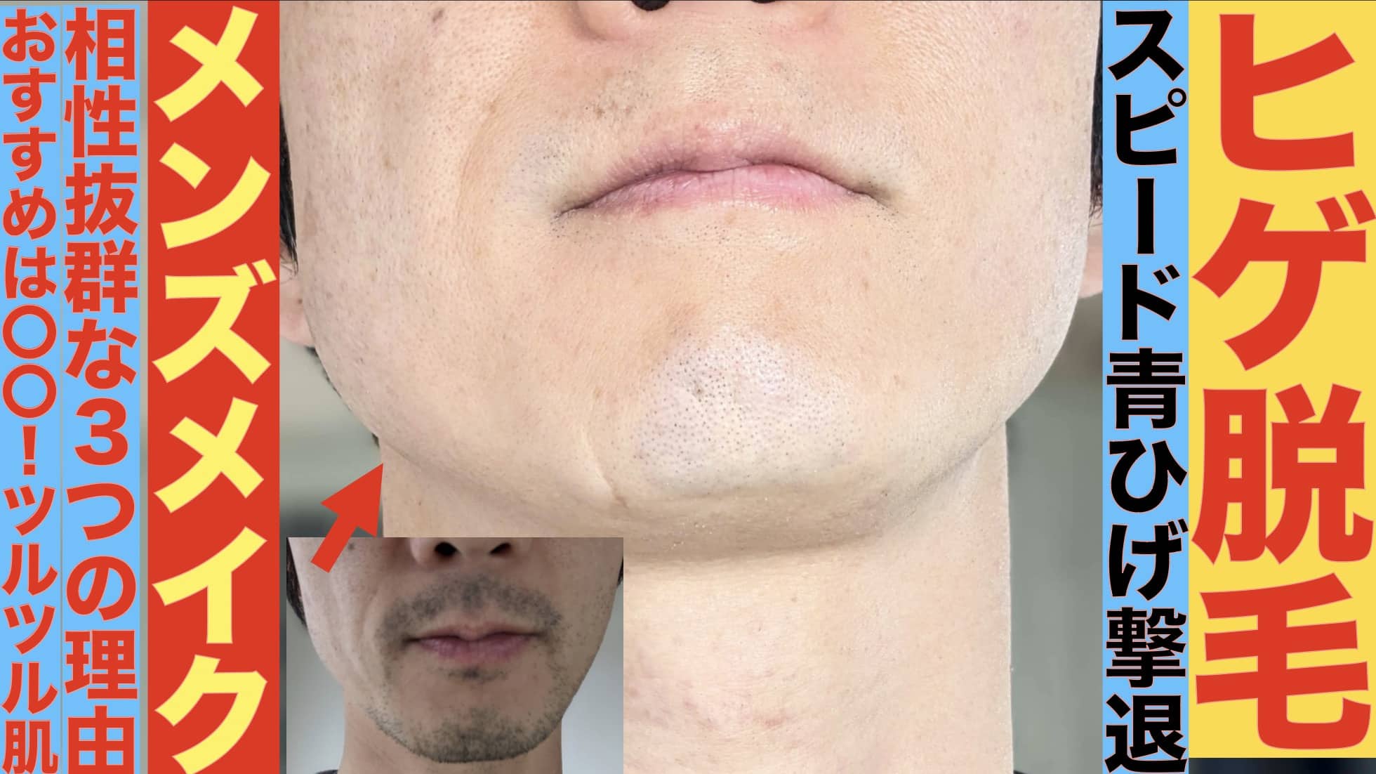 メンズメイクやるならヒゲ脱毛もオススメする３つの理由サムネイル画像1
