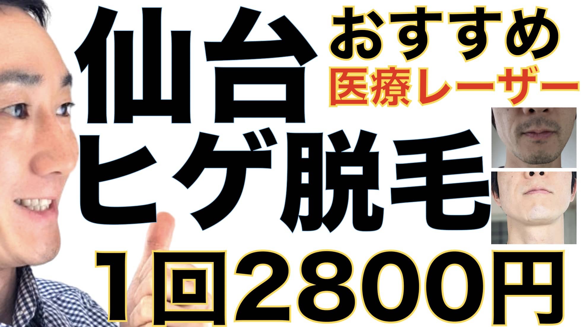 仙台のヒゲ脱毛は湘南美容クリニックがおすすめな３つの理由【1回2800円で医療ヤグレーザー】サムネイル画像