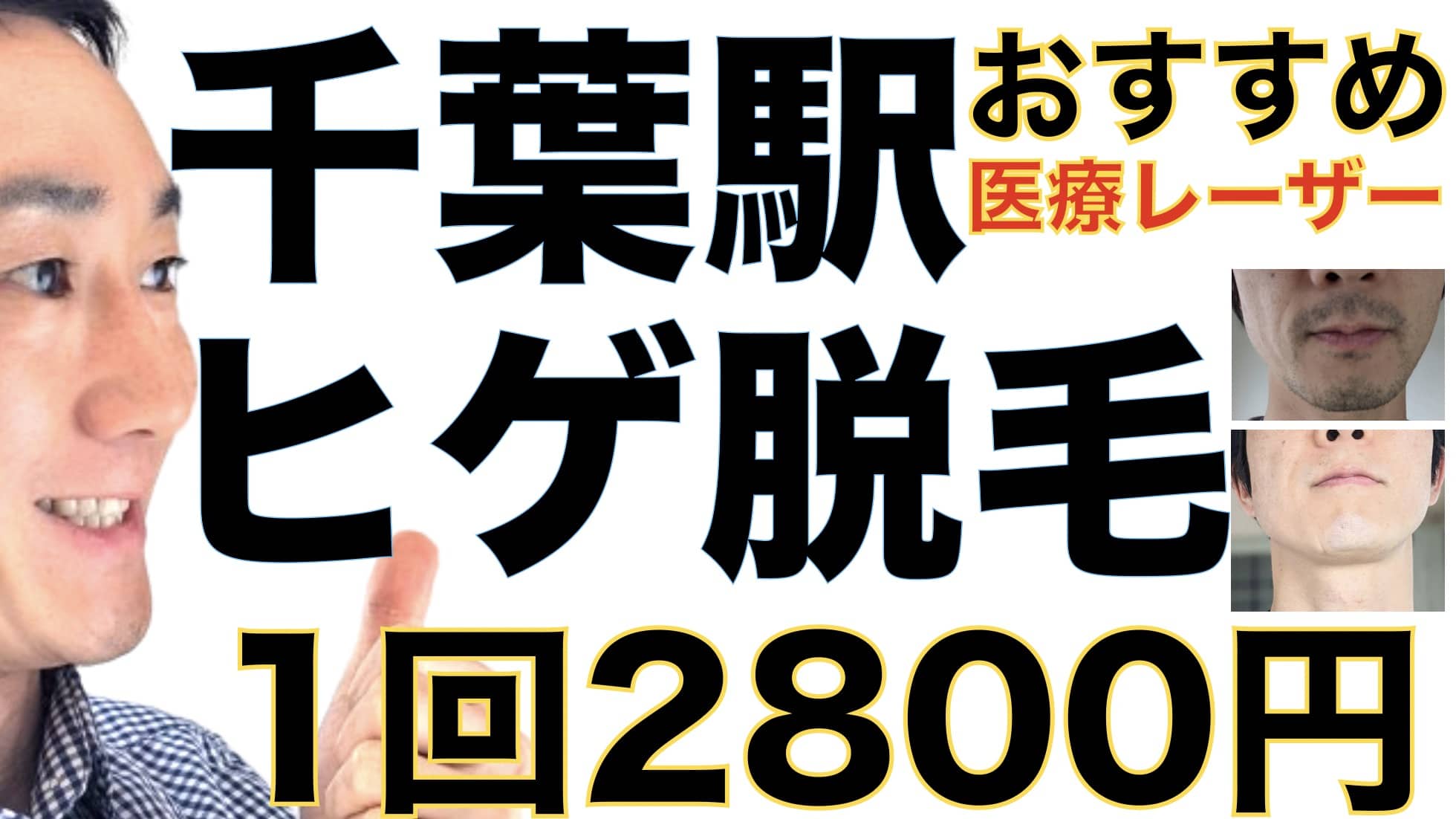 千葉駅のヒゲ脱毛は湘南美容クリニックがおすすめな３つの理由【1回2800円で医療ヤグレーザー】サムネイル画像