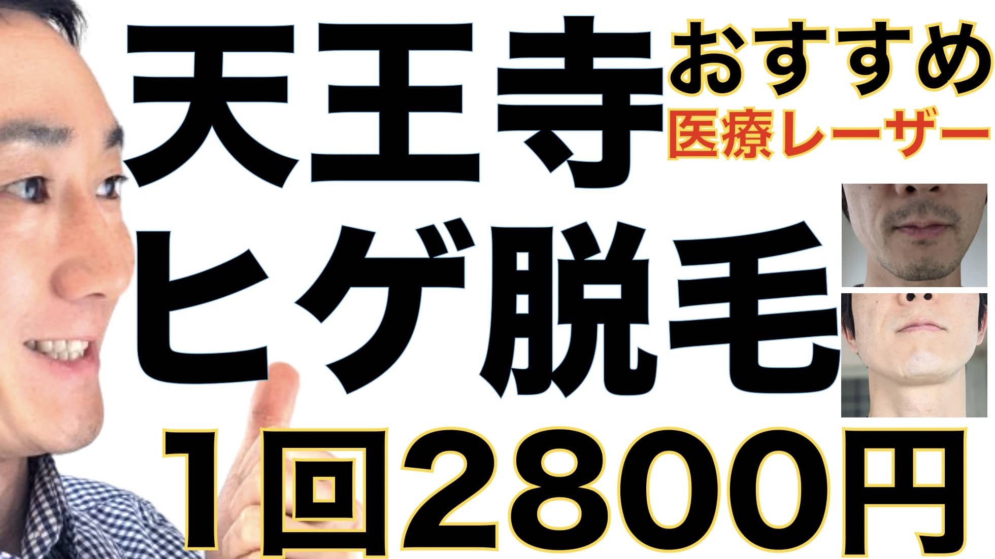 天王寺のヒゲ脱毛は湘南美容クリニックがおすすめな３つの理由【1回2800円で医療ヤグレーザー】サムネイル画像
