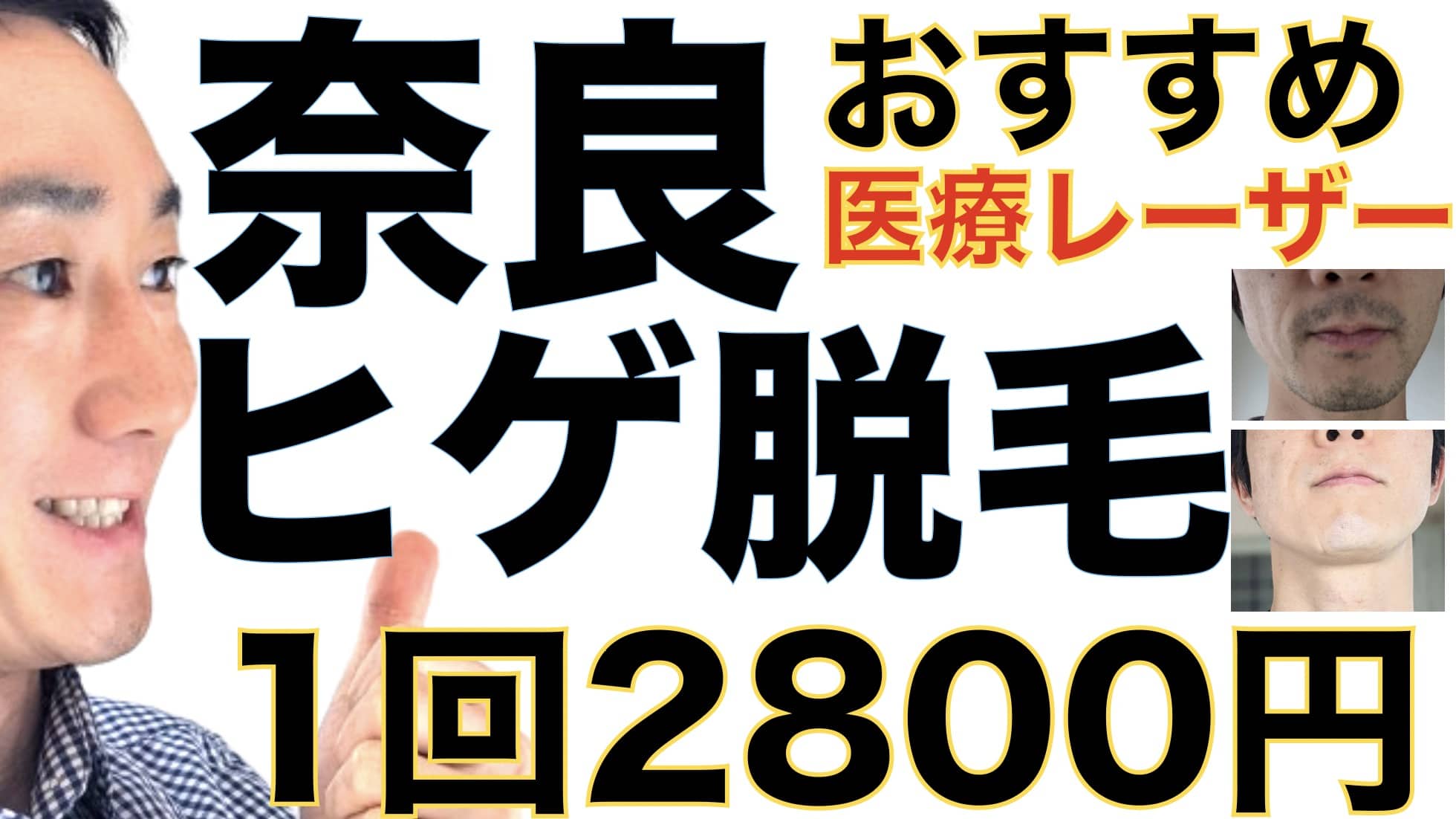 奈良のヒゲ脱毛は湘南美容クリニックがおすすめな３つの理由【1回2800円で医療ヤグレーザー】サムネイル画像