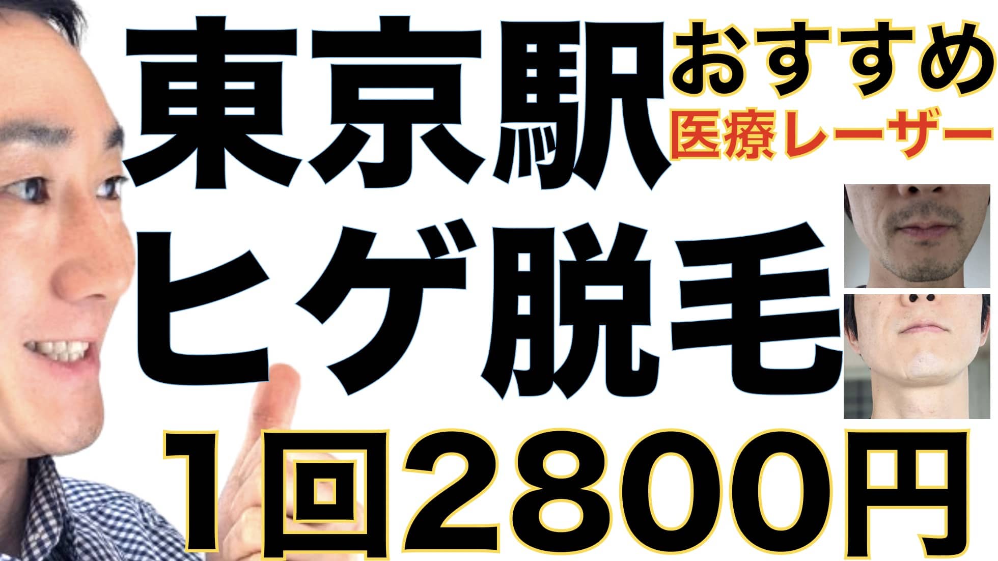 東京駅のヒゲ脱毛は湘南美容クリニックがおすすめな３つの理由【1回2800円で医療ヤグレーザー】サムネイル画像