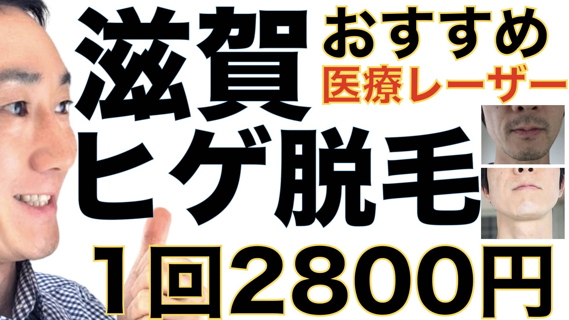 滋賀のヒゲ脱毛は湘南美容クリニックがおすすめな３つの理由【1回2800円で医療ヤグレーザー】サムネイル画像
