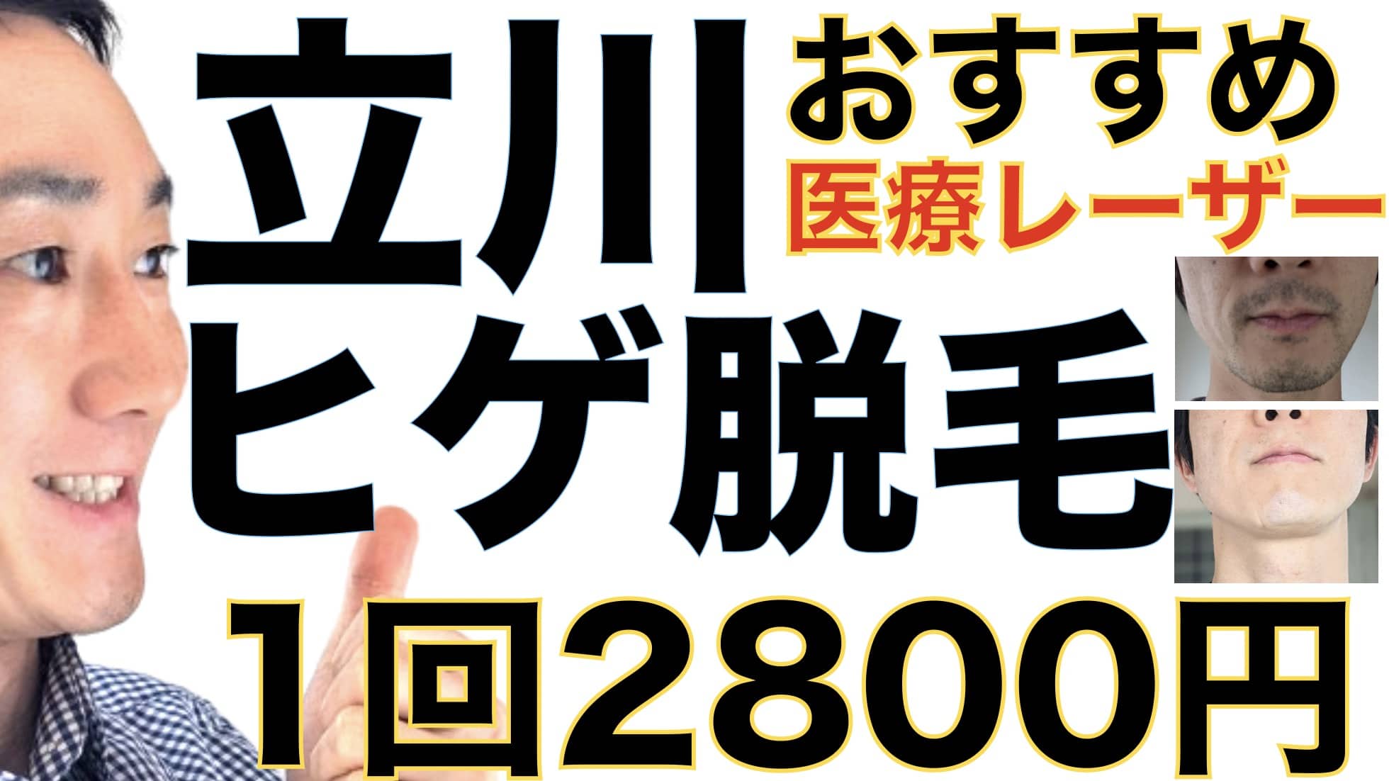 立川のヒゲ脱毛は湘南美容クリニックがおすすめな３つの理由【1回2800円で医療ヤグレーザー】サムネイル画像