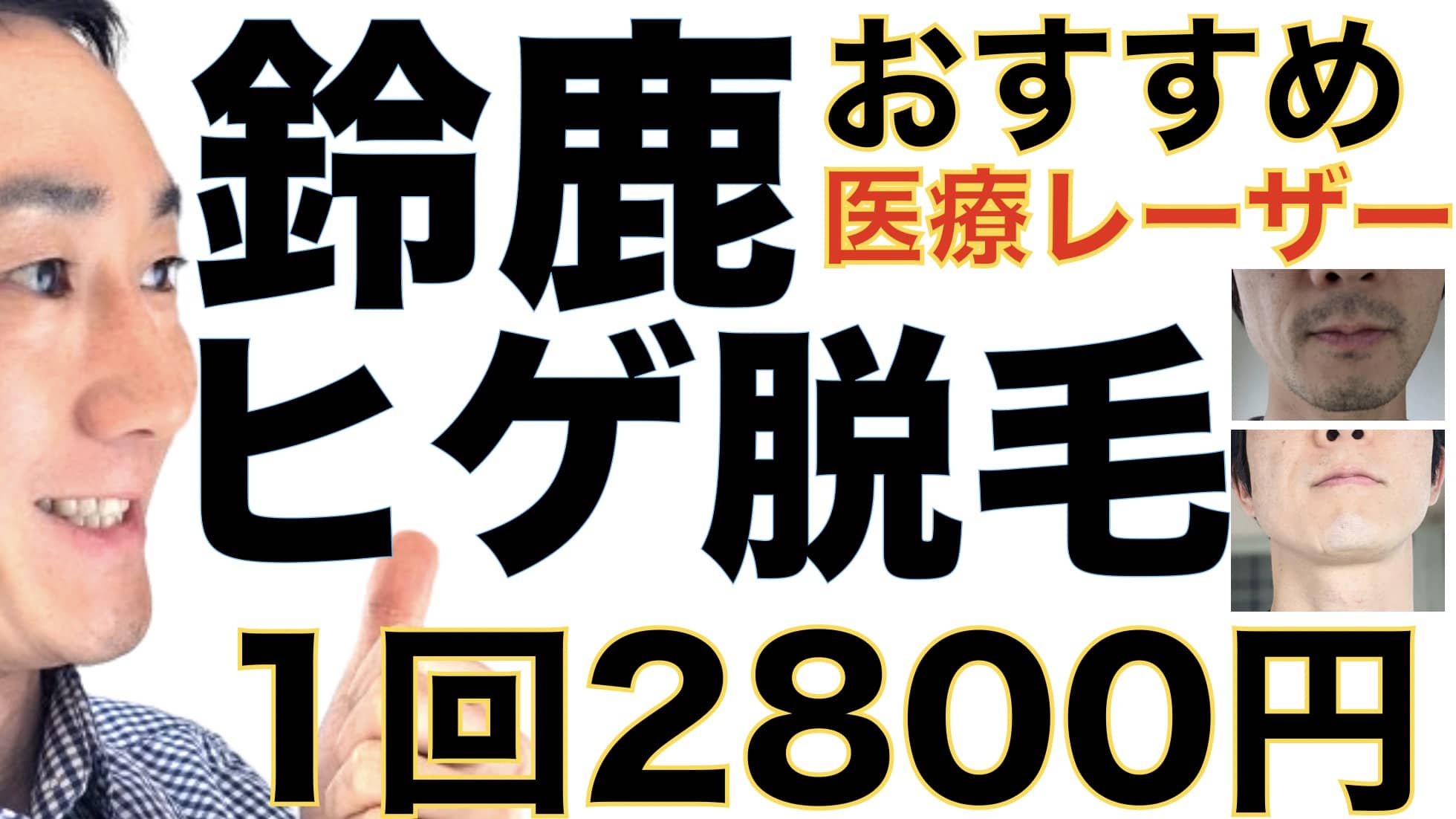 鈴鹿のヒゲ脱毛は湘南美容クリニックがおすすめな３つの理由【1回2800円で医療ヤグレーザー】サムネイル画像