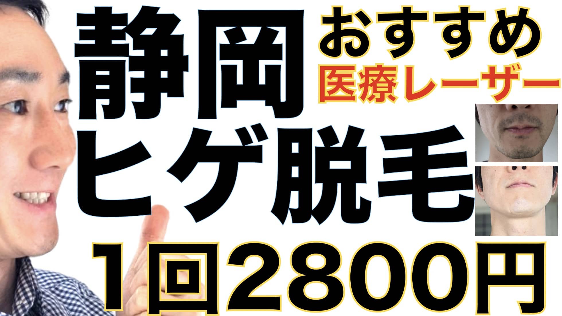 静岡のヒゲ脱毛は湘南美容クリニックがおすすめな３つの理由【1回2800円で医療ヤグレーザー】サムネイル画像