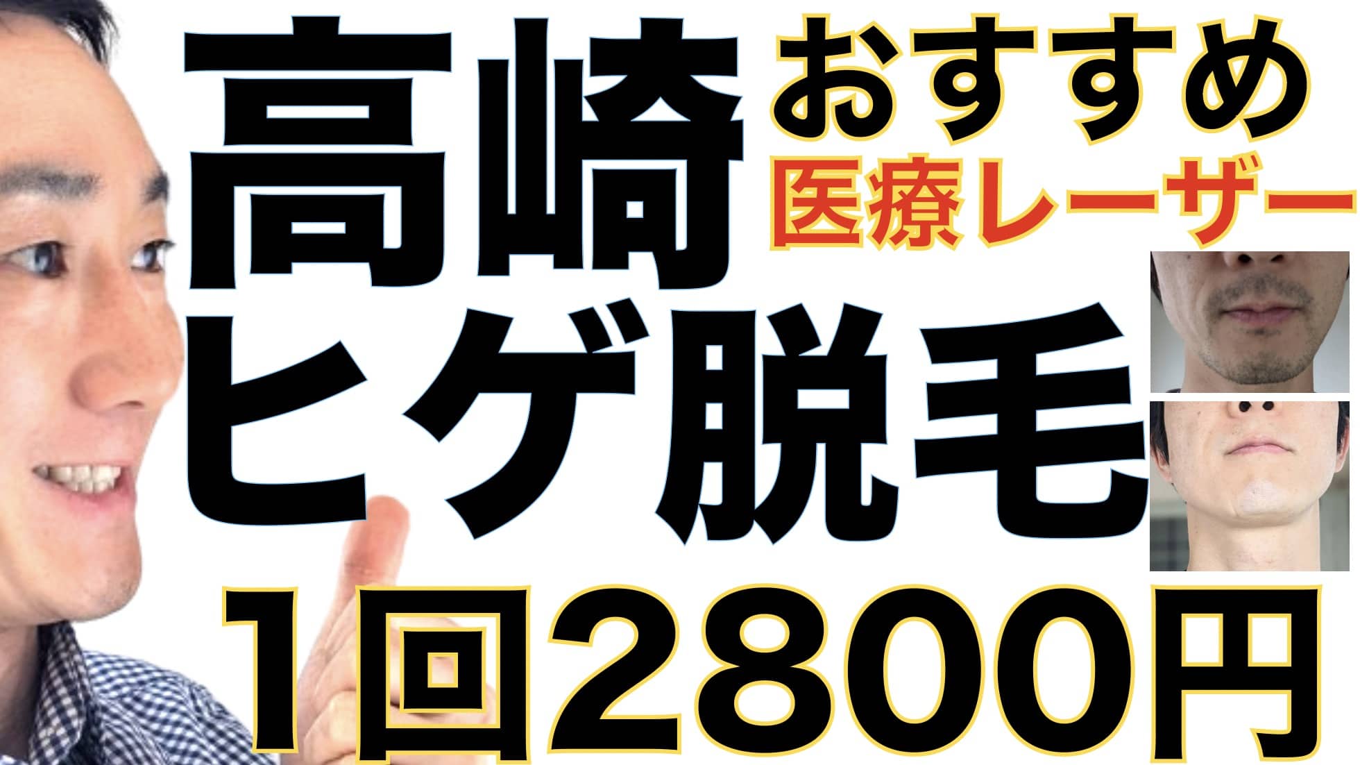 高崎のヒゲ脱毛は湘南美容クリニックがおすすめな３つの理由【1回2800円で医療ヤグレーザー】サムネイル画像