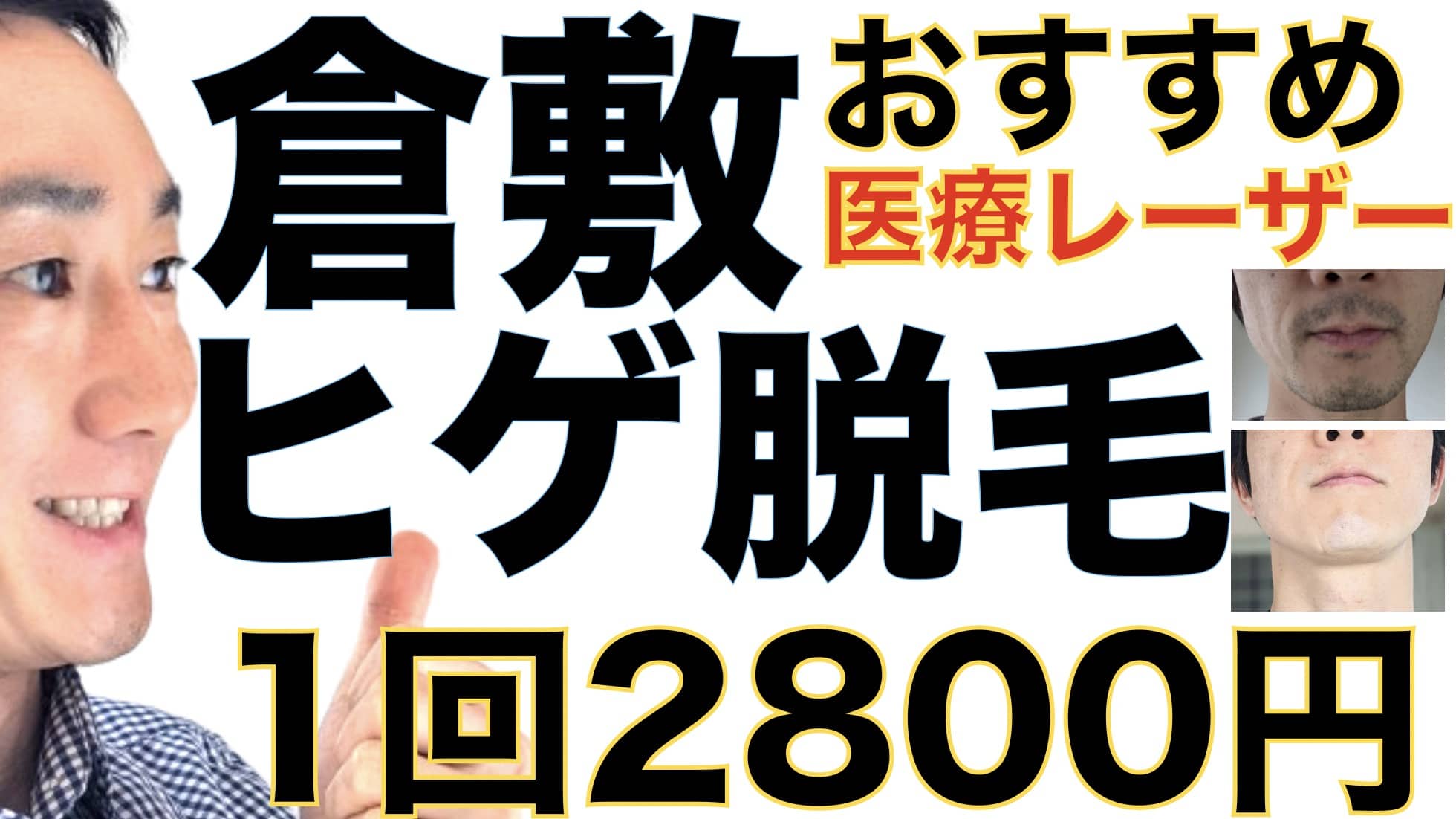 1回2800円で医療ヤグレーザー！倉敷でヒゲ脱毛なら湘南美容クリニックがおすすめな３つの理由サムネイル画像