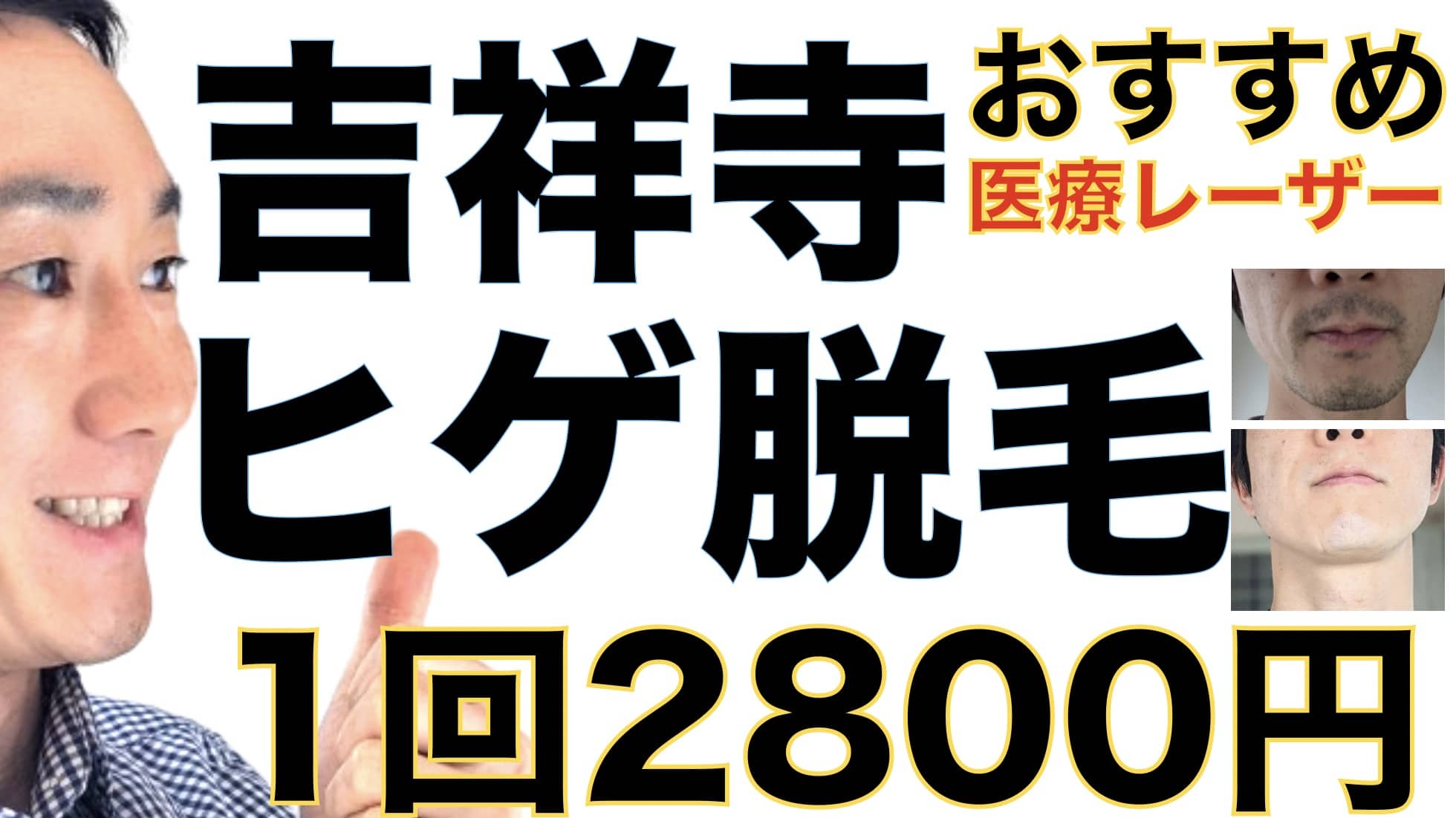 1回2800円で医療ヤグレーザー！吉祥寺でヒゲ脱毛なら湘南美容クリニックがおすすめな３つの理由サムネイル画像