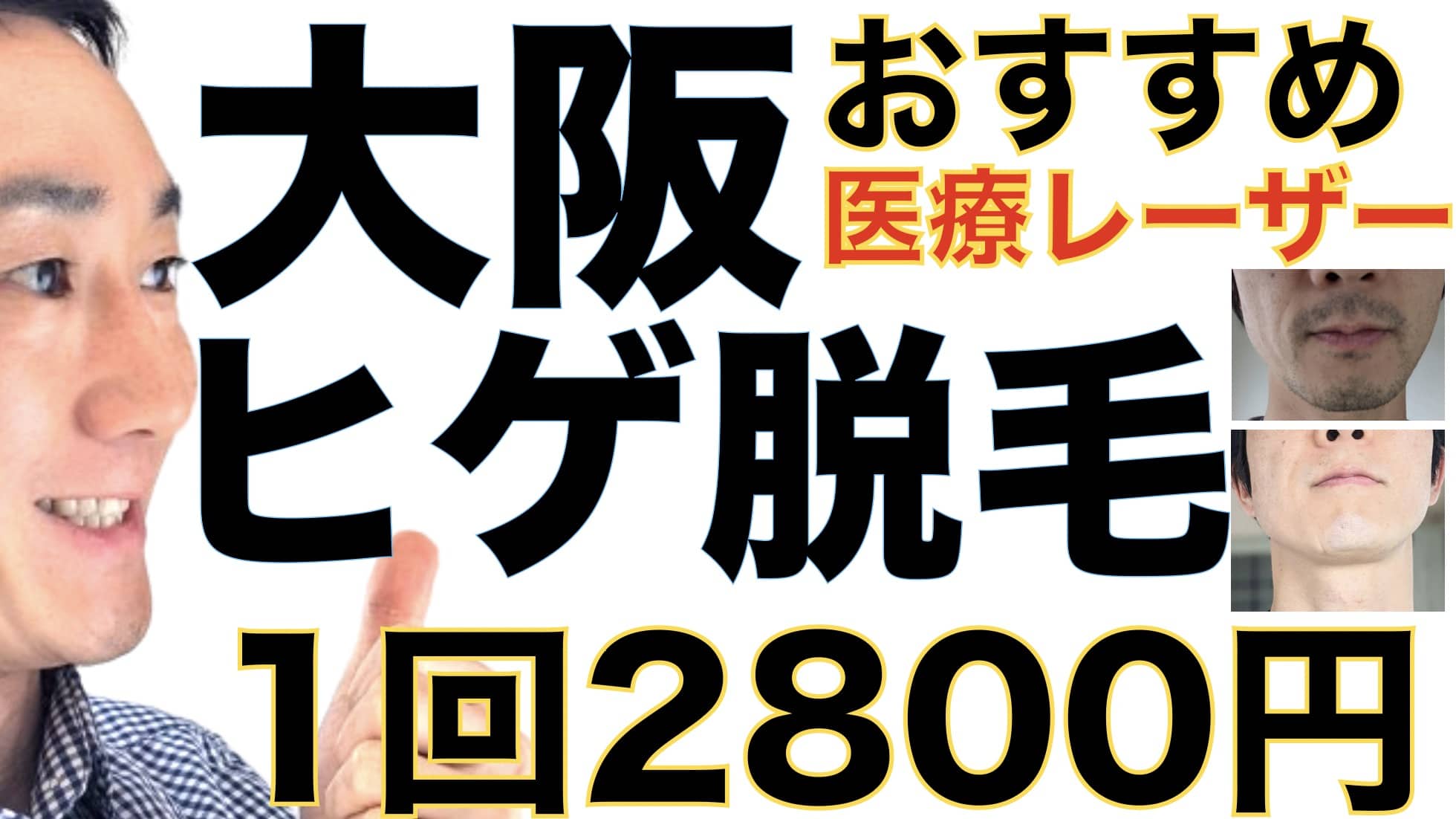 1回2800円で医療ヤグレーザー！大阪でヒゲ脱毛なら湘南美容クリニックがおすすめな３つの理由サムネイル画像2