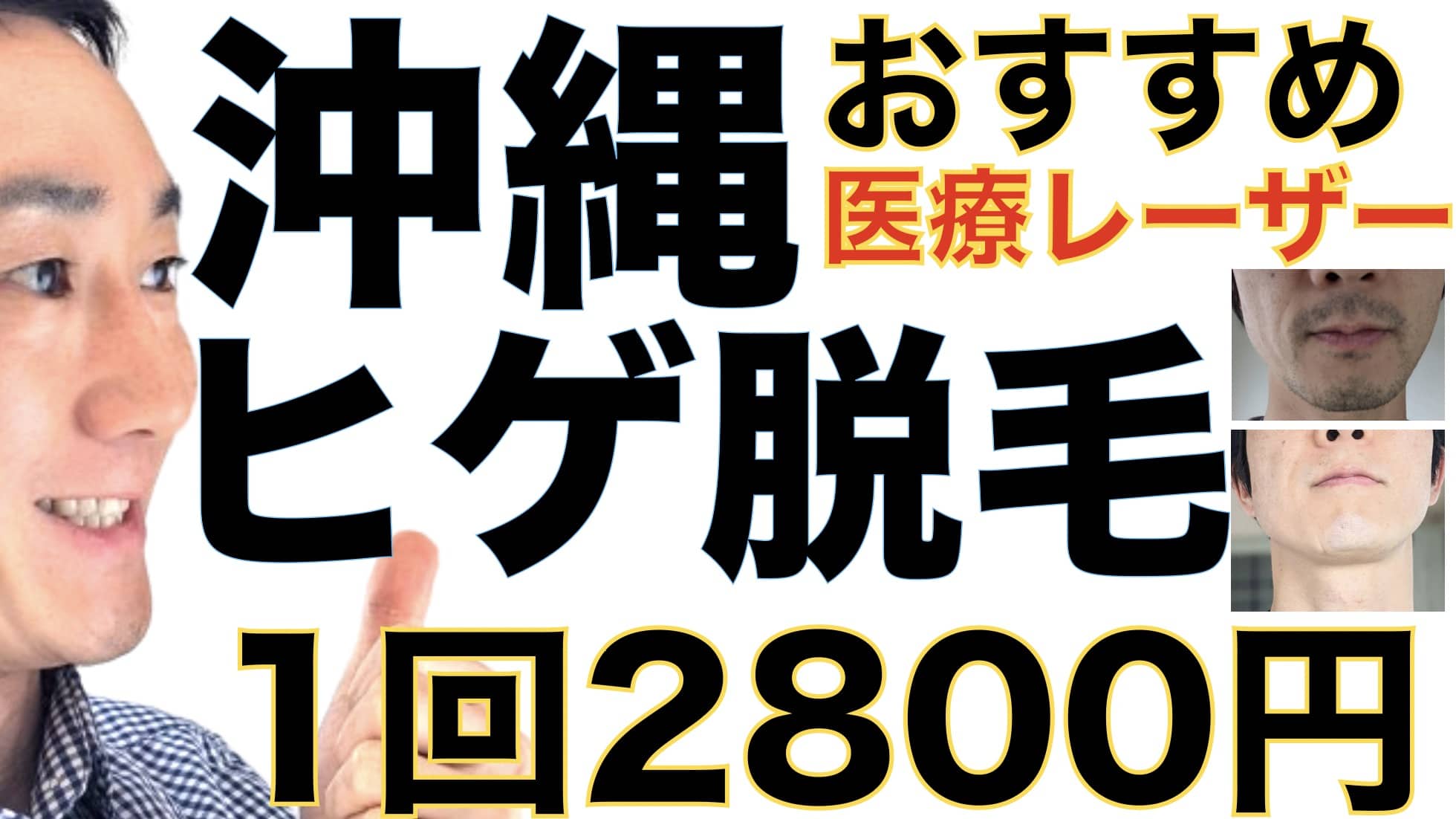 1回2800円で医療ヤグレーザー！沖縄でヒゲ脱毛なら湘南美容クリニックがおすすめな３つの理由サムネイル画像