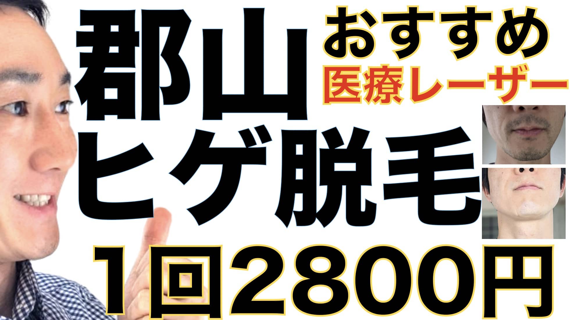 1回2800円で医療ヤグレーザー！郡山でヒゲ脱毛なら湘南美容クリニックがおすすめな３つの理由サムネイル画像