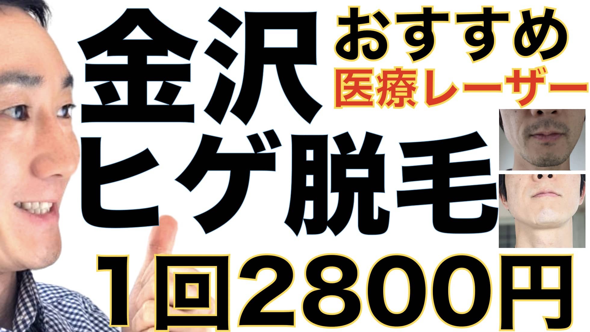 1回2800円で医療ヤグレーザー！金沢でヒゲ脱毛なら湘南美容クリニックがおすすめな３つの理由サムネイル画像