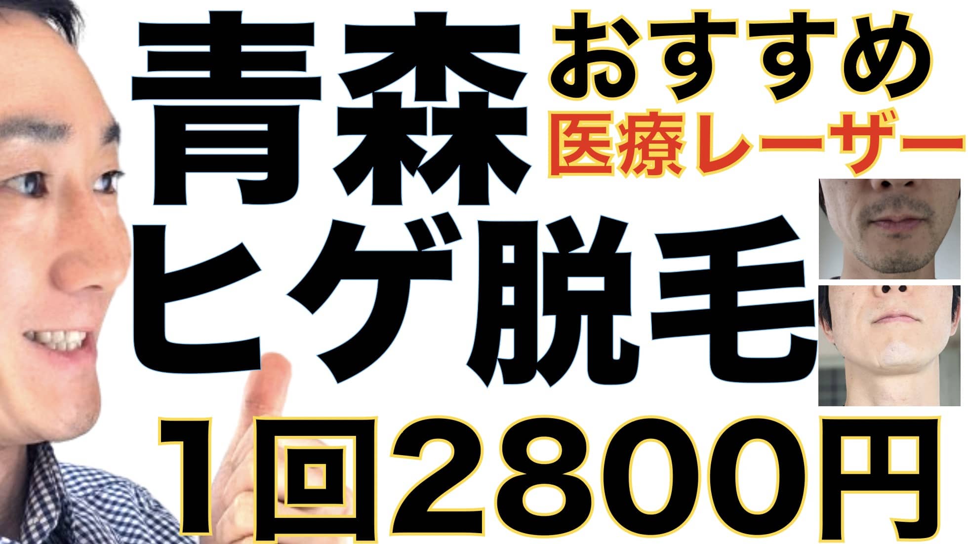 1回2800円で医療ヤグレーザー！青森でヒゲ脱毛なら湘南美容クリニックがおすすめな３つの理由サムネイル画像2