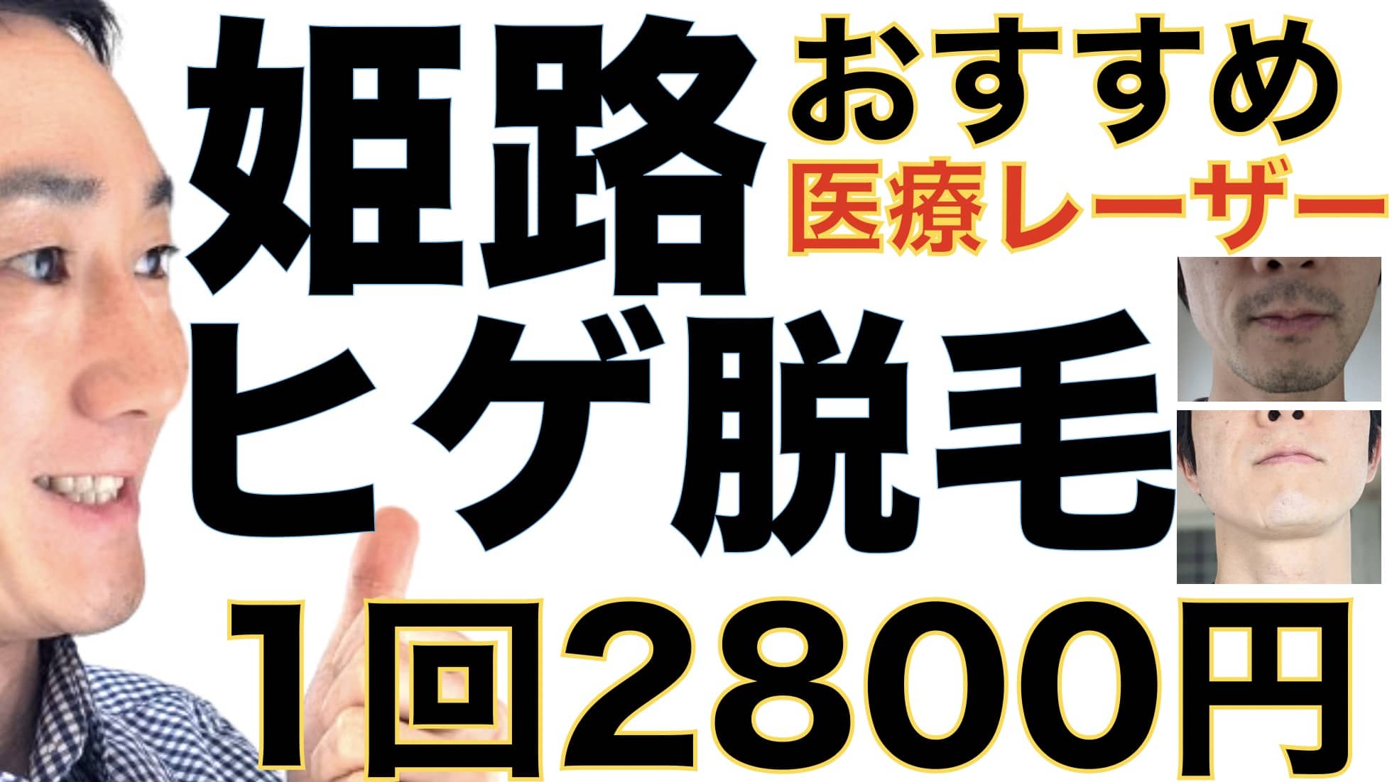 姫路のヒゲ脱毛は湘南美容クリニックがおすすめな３つの理由【1回2800円で医療ヤグレーザー】サムネイル画像