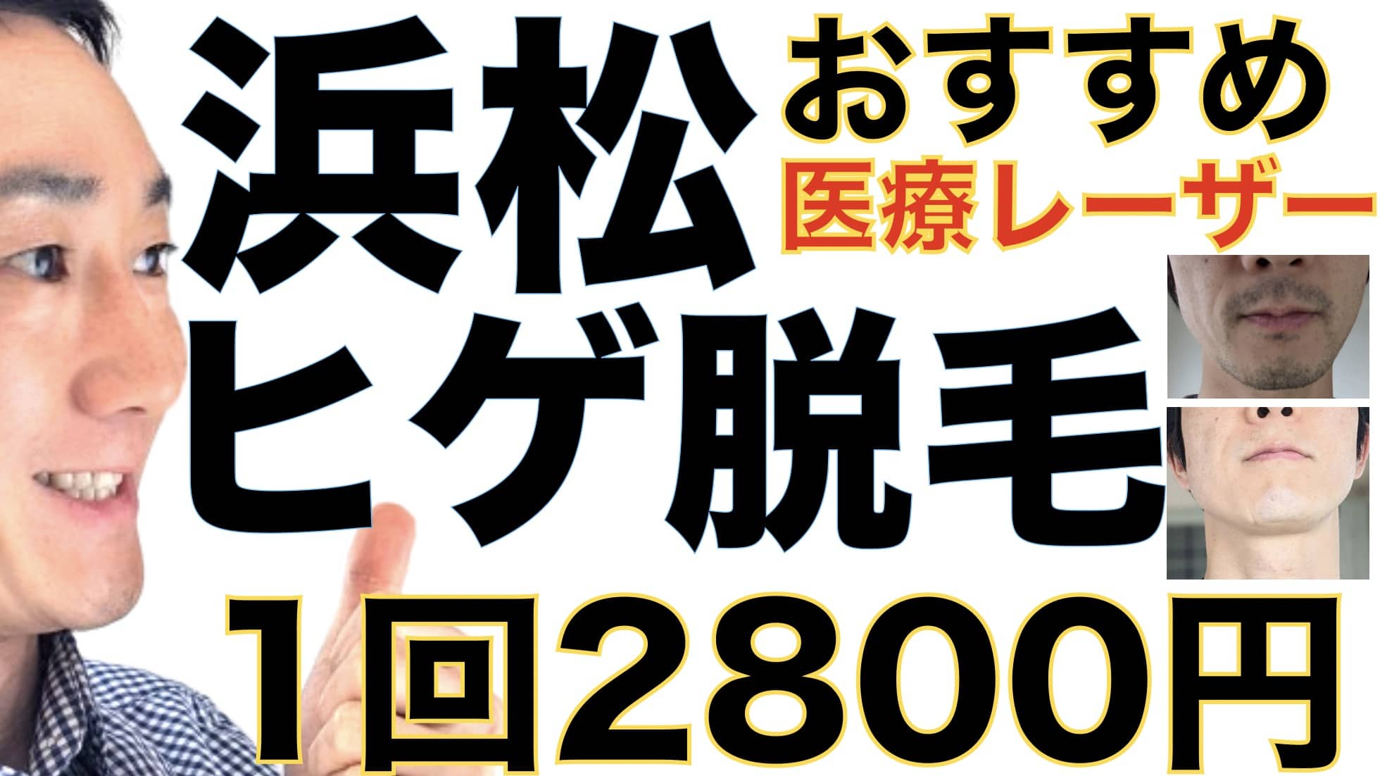 浜松のヒゲ脱毛は湘南美容クリニックがおすすめな３つの理由【1回2800円で医療ヤグレーザー】サムネイル画像