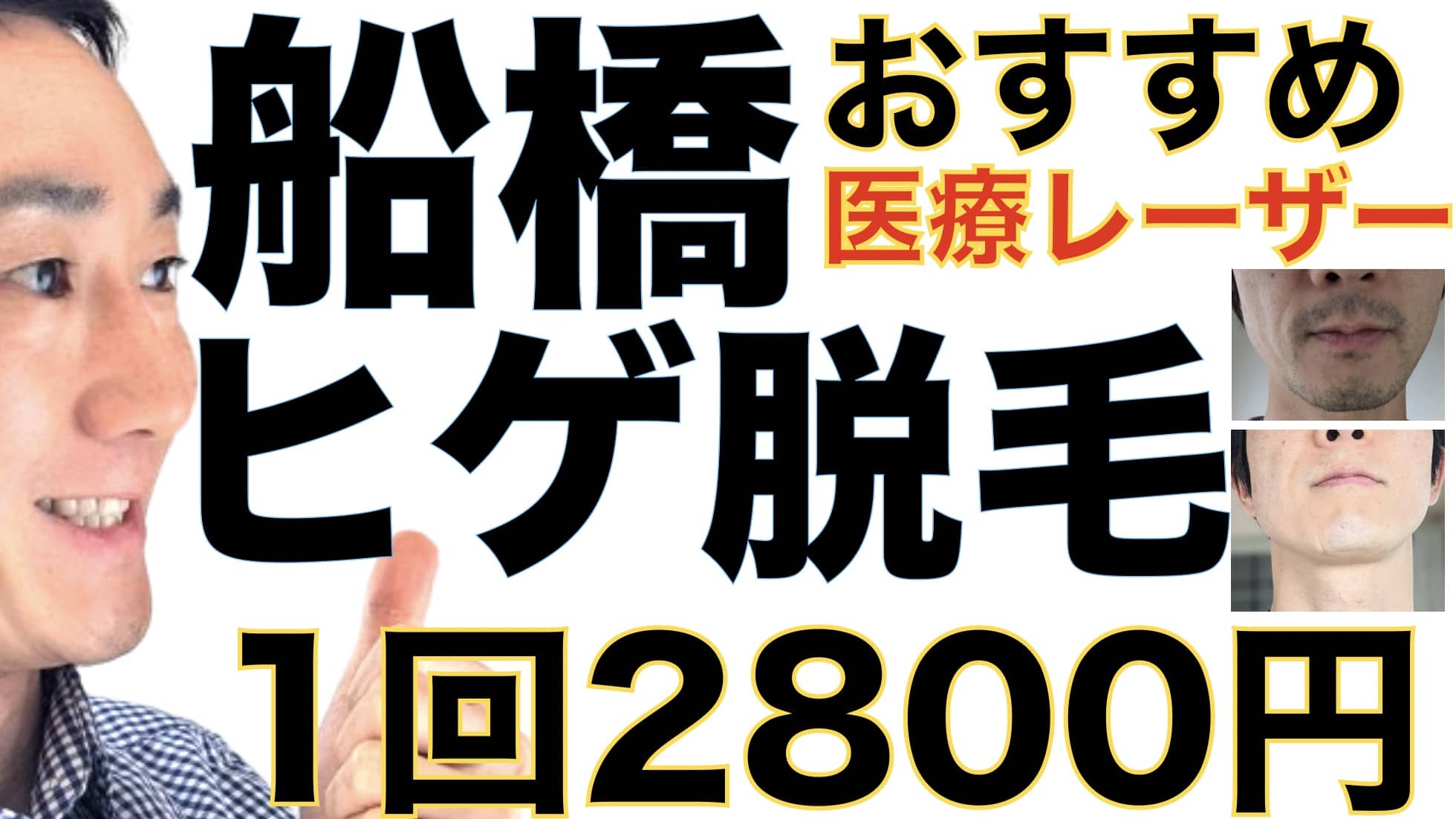 船橋のヒゲ脱毛は湘南美容クリニックがおすすめな３つの理由【1回2800円で医療ヤグレーザー】サムネイル画像